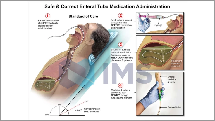 Medical Demonstratives_2_Enteral Tube Medication