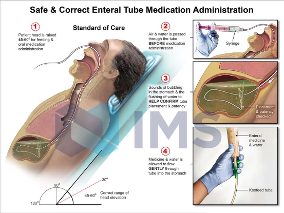 2_Enteral Tube Medication